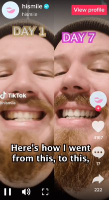 Best Beauty Brands On TikTok: What Are They Doing To Grow?